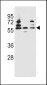 PDP1 Antibody (Center)